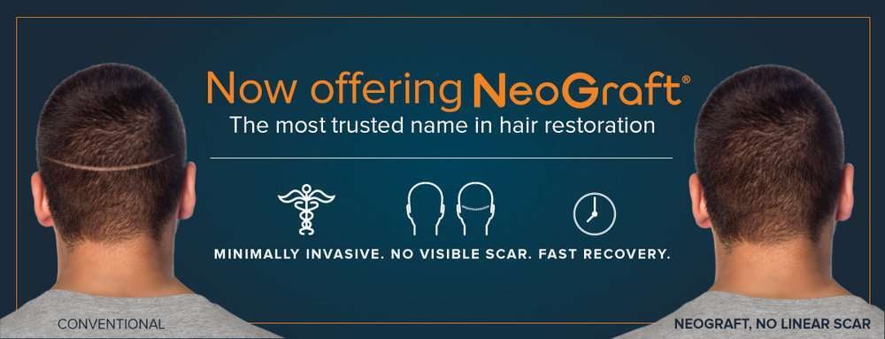 Now Offer Neograft Website Banner